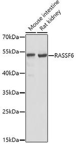 RASSF6 Antibody in Western Blot (WB)