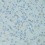 GTF2H2C Polyclonal Antibody