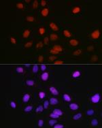 SETD8 Antibody in Immunocytochemistry (ICC/IF)