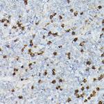 CD63 Antibody in Immunohistochemistry (Paraffin) (IHC (P))