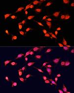 H3K14me3 Polyclonal Antibody