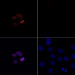 H4K16ac Antibody in Immunocytochemistry (ICC/IF)