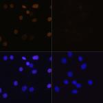 H4K16ac Antibody in Immunocytochemistry (ICC/IF)