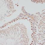 Cyclin G1 Antibody in Immunohistochemistry (Paraffin) (IHC (P))