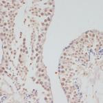 Cyclin G1 Polyclonal Antibody
