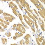 EMAP II Antibody in Immunohistochemistry (Paraffin) (IHC (P))