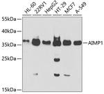 EMAP II Antibody in Western Blot (WB)
