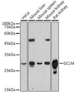 GCLM Antibody in Western Blot (WB)