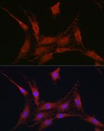 SLC4A4 Polyclonal Antibody