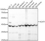 ACAT1 Polyclonal Antibody