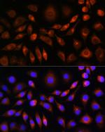 Apolipoprotein M Antibody in Immunocytochemistry (ICC/IF)