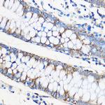 Apolipoprotein M Antibody in Immunohistochemistry (Paraffin) (IHC (P))