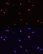 HDGF Antibody in Immunocytochemistry (ICC/IF)