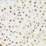 HDGF Antibody in Immunohistochemistry (Paraffin) (IHC (P))