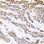 HDGF Antibody in Immunohistochemistry (Paraffin) (IHC (P))