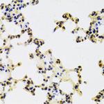 HDGF Antibody in Immunohistochemistry (Paraffin) (IHC (P))