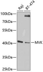 MVK Polyclonal Antibody
