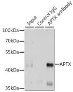 Aprataxin Antibody in Immunoprecipitation (IP)