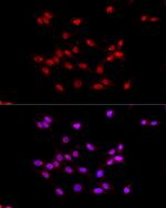 EED Antibody in Immunocytochemistry (ICC/IF)
