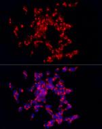CARTPT Polyclonal Antibody