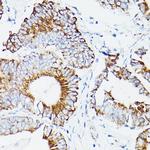 DLD Polyclonal Antibody
