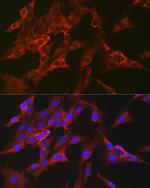 FBP1 Antibody in Immunocytochemistry (ICC/IF)