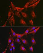 FBP1 Polyclonal Antibody