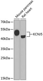 Kir3.4 (KCNJ5) Polyclonal Antibody