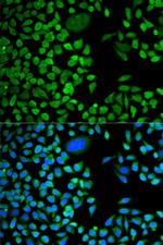 TIA-1 Antibody in Immunocytochemistry (ICC/IF)