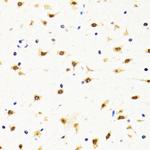 TIA-1 Antibody in Immunohistochemistry (Paraffin) (IHC (P))