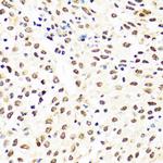 TIA-1 Antibody in Immunohistochemistry (Paraffin) (IHC (P))
