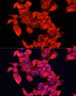 KAO Antibody in Immunocytochemistry (ICC/IF)