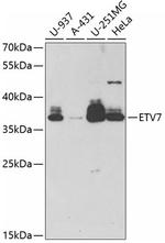 ETV7 Polyclonal Antibody