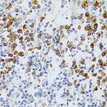 CAF1 p60 Antibody in Immunohistochemistry (Paraffin) (IHC (P))