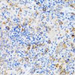 CAF1 p60 Antibody in Immunohistochemistry (Paraffin) (IHC (P))
