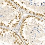 RAD51 Polyclonal Antibody