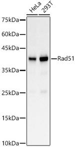 RAD51 Antibody in Western Blot (WB)