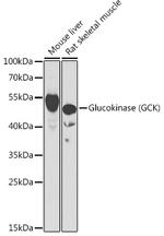GCK Polyclonal Antibody