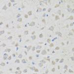 PENK Antibody in Immunohistochemistry (Paraffin) (IHC (P))