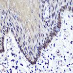 Transketolase Polyclonal Antibody