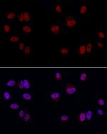 GAS41 Polyclonal Antibody