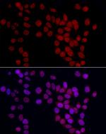 GAS41 Antibody in Immunocytochemistry (ICC/IF)
