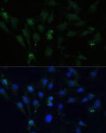 ZWINT Antibody in Immunocytochemistry (ICC/IF)