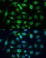 ZWINT Antibody in Immunocytochemistry (ICC/IF)