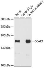 CCAR1 Antibody in Immunoprecipitation (IP)