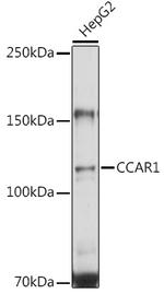 CCAR1 Antibody in Western Blot (WB)