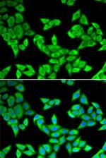 CIAPIN1 Polyclonal Antibody