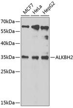 ALKBH2 Polyclonal Antibody