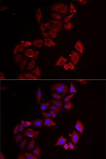 LIMS1 Polyclonal Antibody