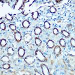 NDUFS4 Polyclonal Antibody